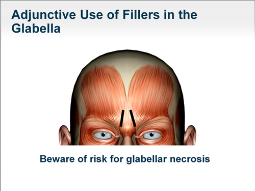 Slide 39.