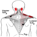 Myofascial Trigger Points in Patients with Shoulder Pain - Page 2