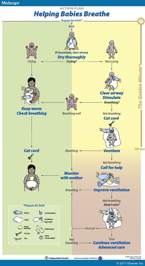 Neonatal Nursing and Helping Babies Breathe Page 3