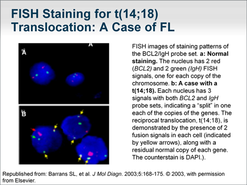 Follicular Lymphoma: Evaluating First-Line Treatment Options (Transcript)