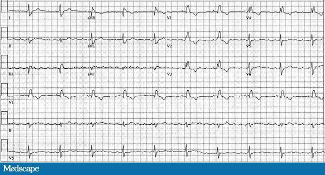 telemetry artifact meaning telemetry artifact meaning