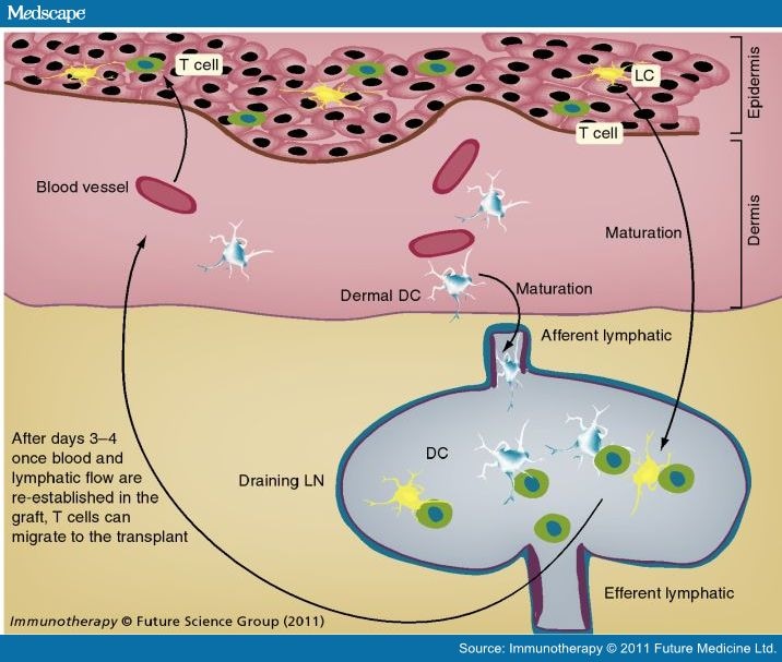 Immune Recognition and Rejection of Allogeneic Skin Grafts