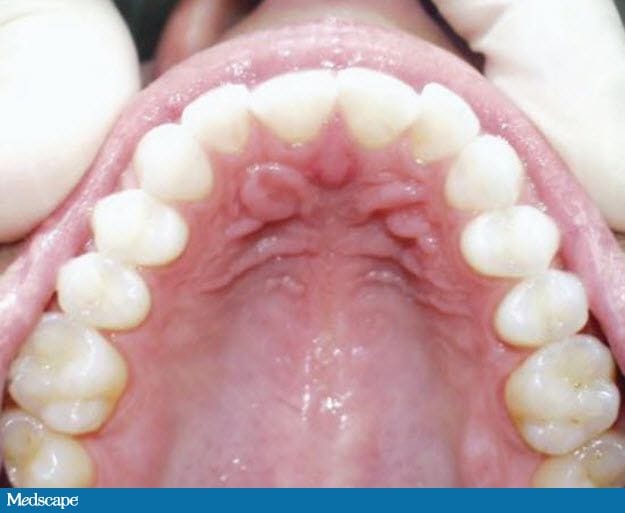 Beyond Wires and Brackets: A Modern Tooth Movement - Page 4