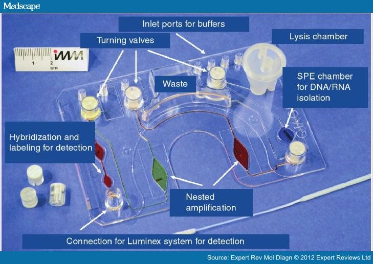 Samples for Diagnosis of Infectious Diseases