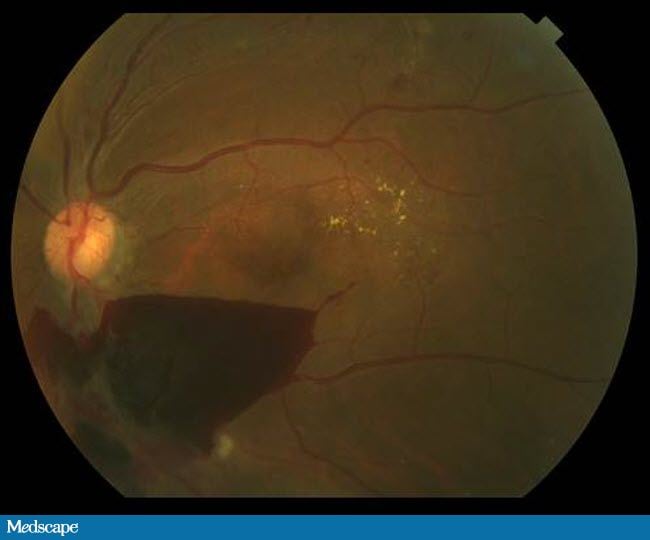 gfxcardstatus 2012 retina