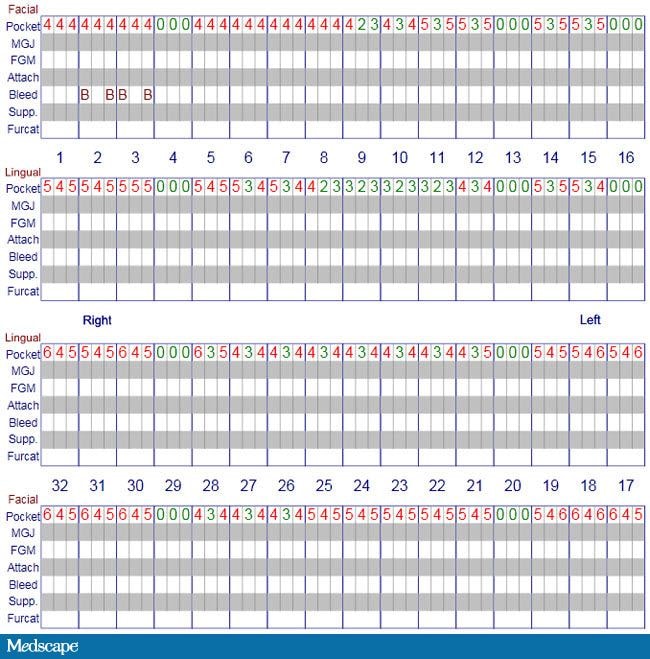 Dental Periodontal Chart