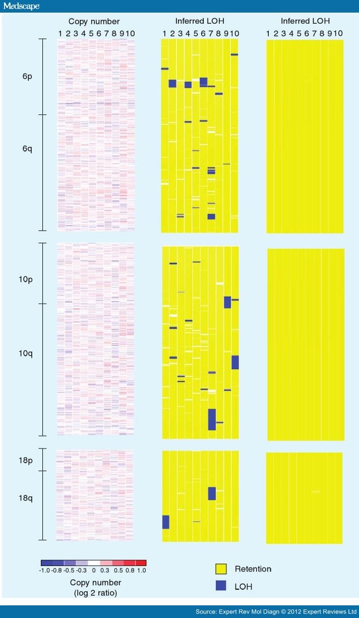 Copy Number Alterations in AML and Myelodysplastic Syndromes - Page 3