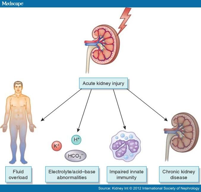 AKI in the ICU: Epidemiology and Risk Stratification