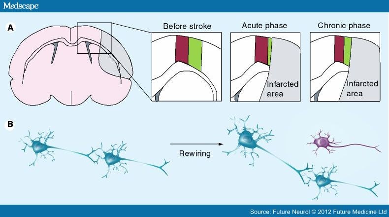Enhancing Neuroplasticity and Regeneration After Stroke