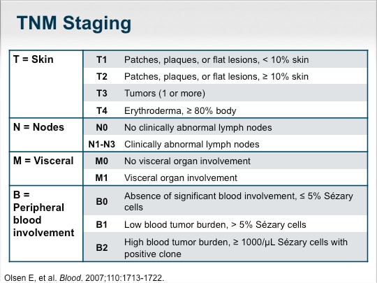 Aiming for Consensus in the Treatment of T-Cell Lymphomas (Transcript)