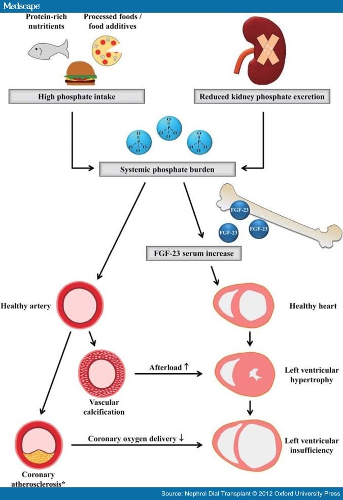 FGF-23: Novel Cardiovascular Risk Marker in CKD