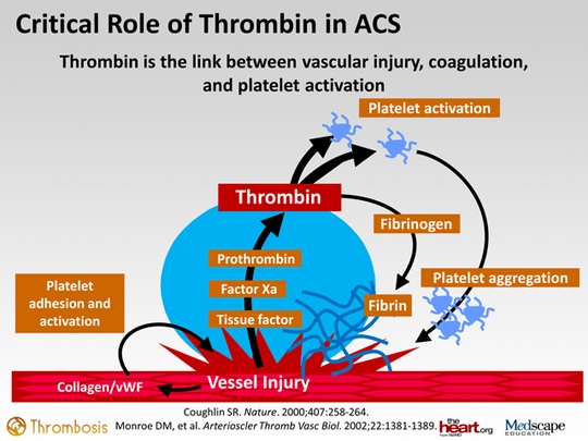 Taking a Closer Look at Thrombin and Its Role in ACS (Transcript)