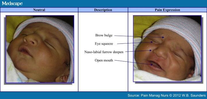 Biobehavioral Measures for Pain in the Pediatric Patient