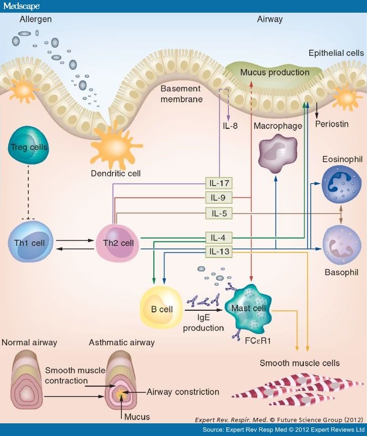 Targeting Interleukins to Treat Severe Asthma