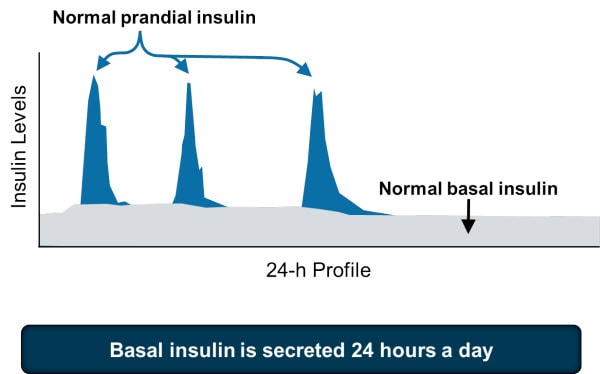 Injectable Therapy in Type 2 Diabetes and the Need to Intensify Treatment