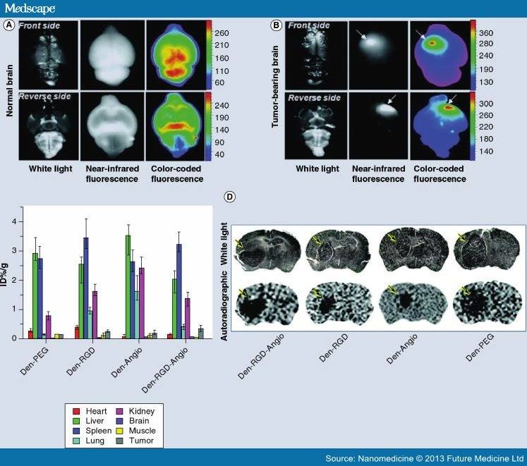 Nanoparticles for Imaging and Treating Brain Cancer Page 8