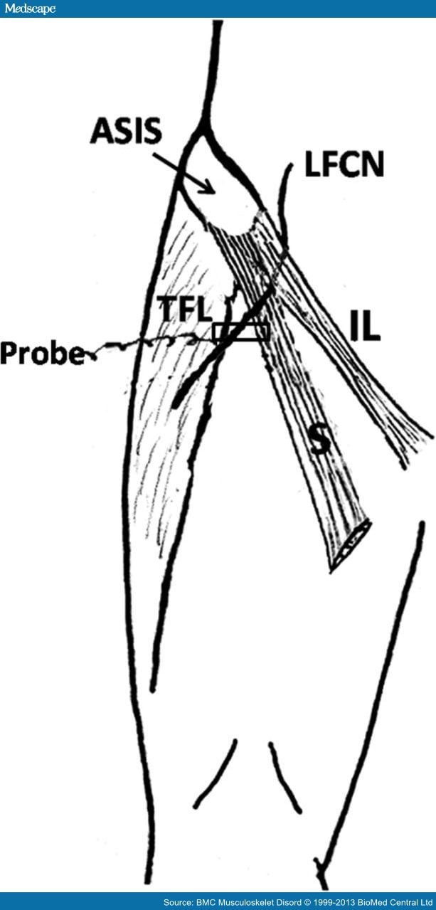 Ultrasound of the Lateral Femoral Cutaneous Nerve in Adults