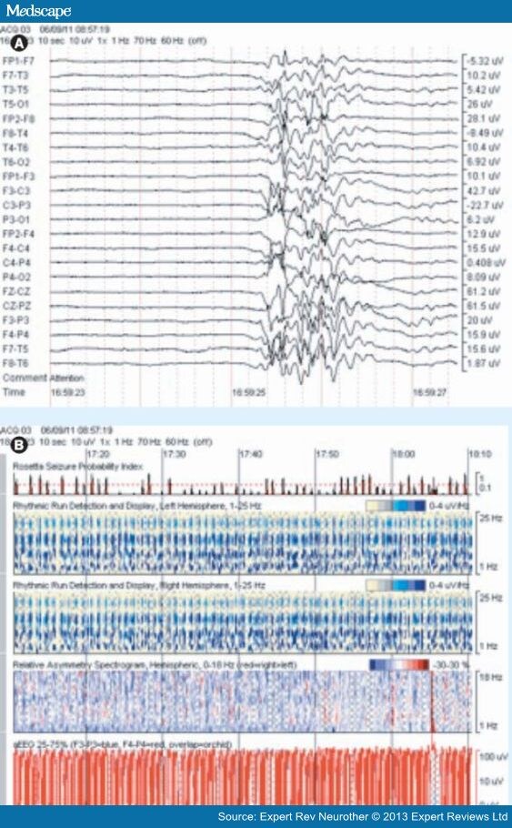 New Approaches To Bedside Monitoring In Stroke - Page 6