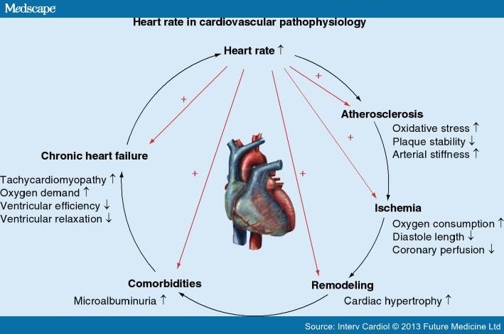 Ivabradine The Start of a SHIFT in Heart Failure Treatment