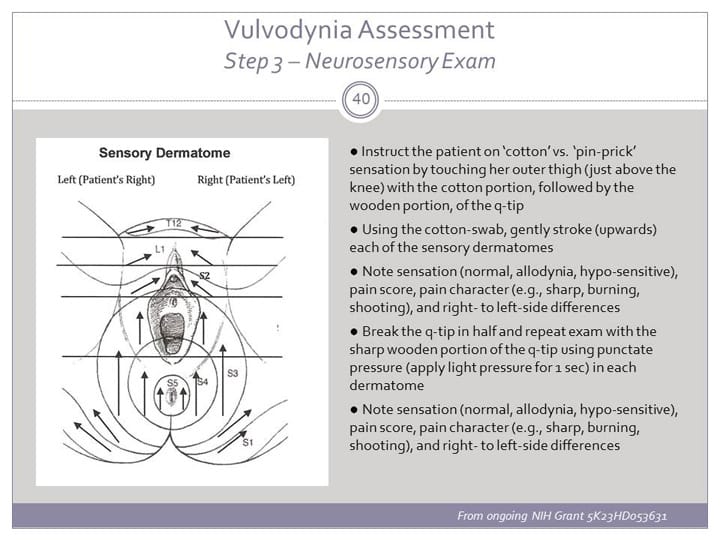 Vulvodynia: An Under-recognized Pain Disorder Affecting 1 in 4