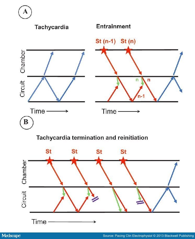 Resetting and Entrainment of Reentrant Arrhythmias: Part I - Page 4