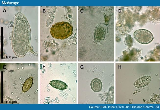 Persistent Digestive Disorders in the Tropics - Page 4