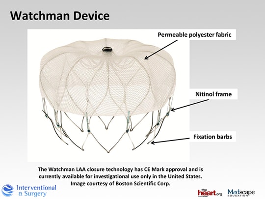 Slide 12.