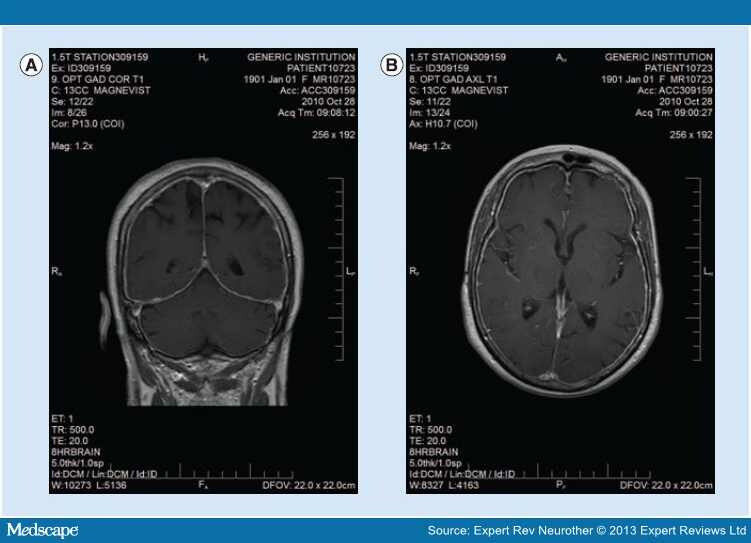 MRI in Headache - Page 15