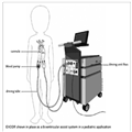 Clinical Management of Pediatric Ventricular Assist Devices - Page 4