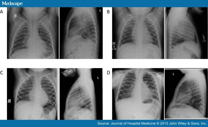 Impact of Clinical History on Chest Radiograph Interpretation - Page 3