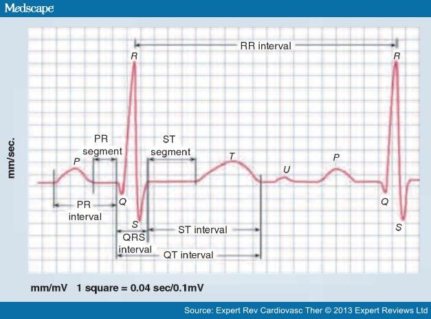 ECG Abnormalities and Stroke Incidence