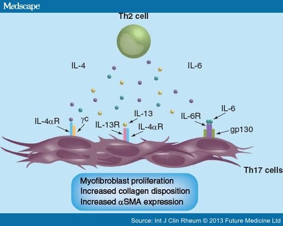 Therapeutic Targeting of T Cells in Systemic Sclerosis - Page 4