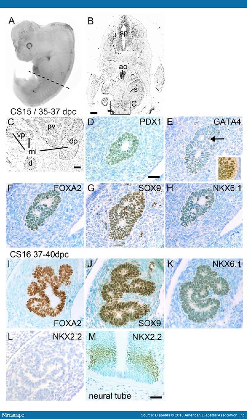 Development Of The Human Pancreas Page 3   812195 Fig4 