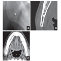 Tonsilloliths on CT and Panoramic Radiographs - Page 4
