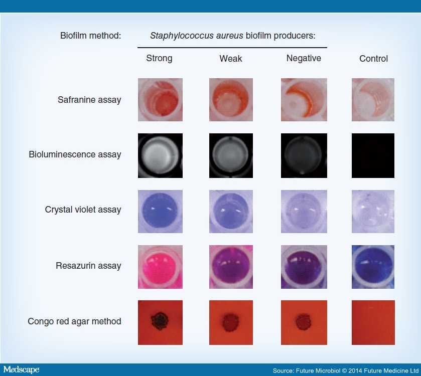Quantitative Assessment of Staphylococcus Aureus Biofilms Page 3