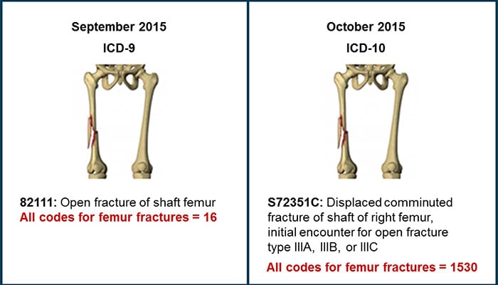 periprosthetic supracondylar fracture of femur icd 10