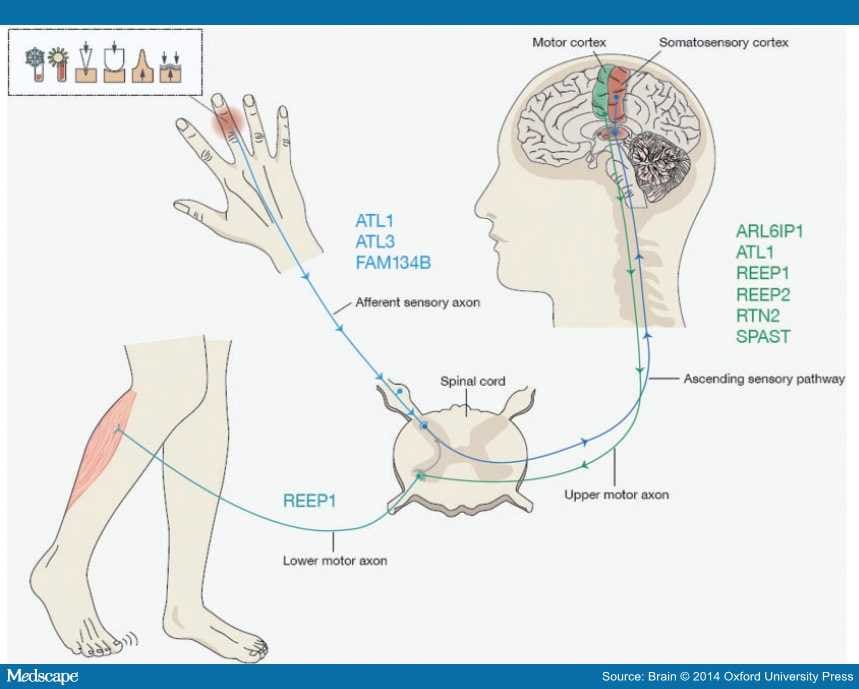 Membrane-shaping Disorders: A Pathway in Axon Degeneration