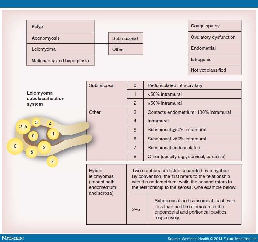 Типы миомы матки по figo. Классификация миомы по Фиго. Типы узлов миомы матки по УЗИ. Классификация Фиго миома матки. Классификация миоматозных узлов по Figo.