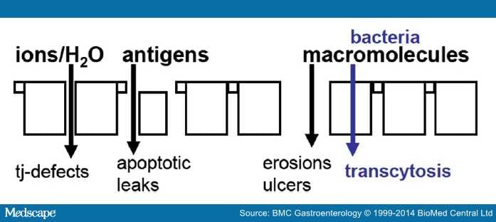 Intestinal Permeability -- A New Target For Disease