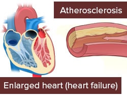 Fast Five Quiz: Ischemic Stroke - Page 3