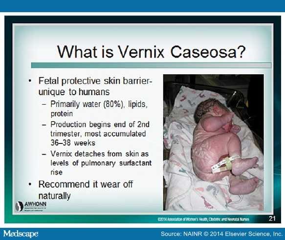 What Is Vernix Caseosa?