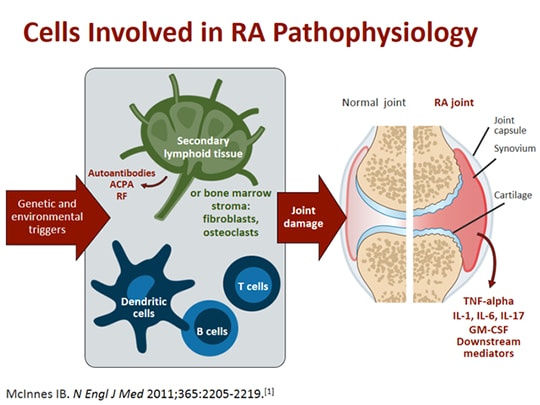 Pathophysiology Of Rheumatoid Arthritis Diagram 