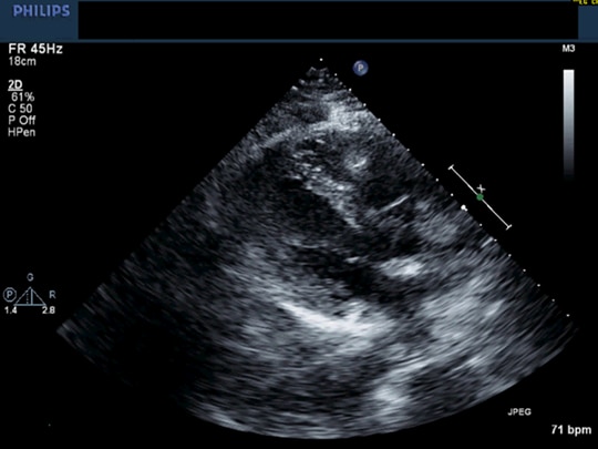 A Differential Diagnosis