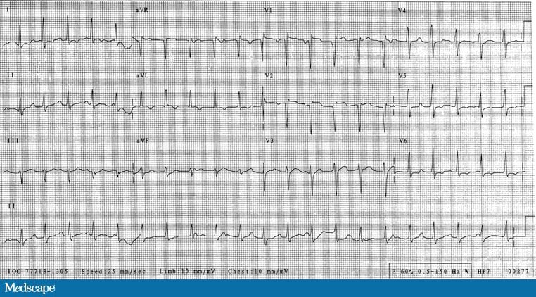 Palpitations in a 19-Year-Old With a Rash - Page 2