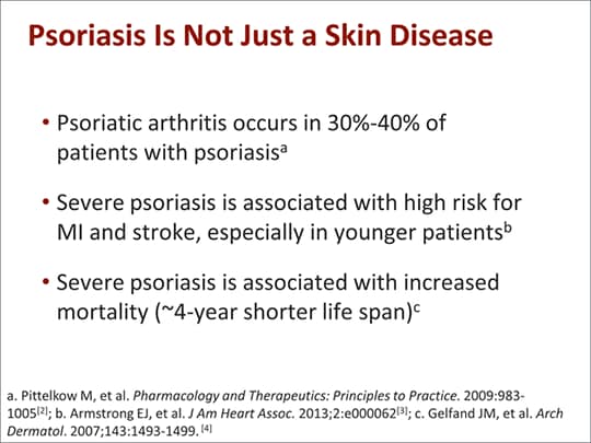 Treatment Advances in Moderate to Severe Psoriasis (Transcript)