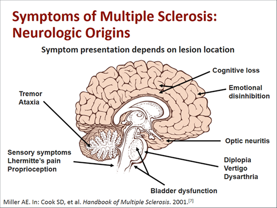 New Challenges Facing Multiple Sclerosis Nurses (Transcript)
