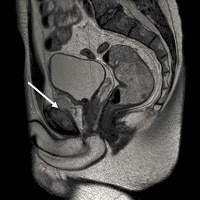 Abdominal Pain and Fatigue in a Soccer Player - Page 2