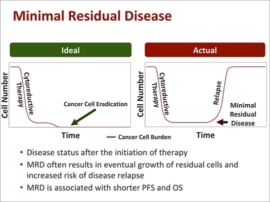 The Role of MRD in Hematologic Malignancies (Transcript)