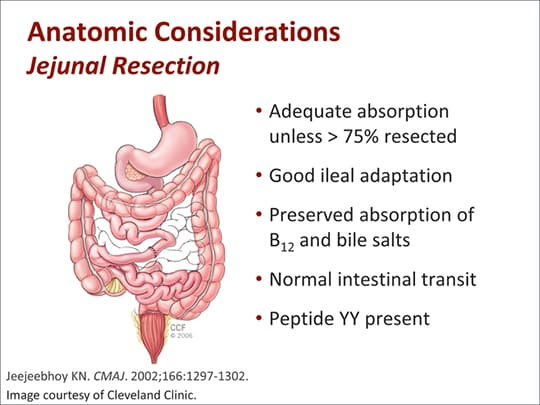 Clinical Considerations in the Management of Short Bowel Syndrome ...