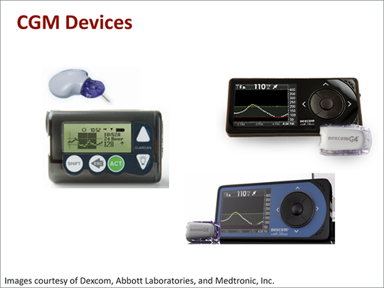 Technology Advances in Continuous Glucose Monitoring (Transcript)